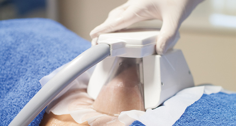 How Fat Freezing and HIFU Work Together? 2 Multiple Areas in One Session HIFU and Fat Freezing Bournemouth