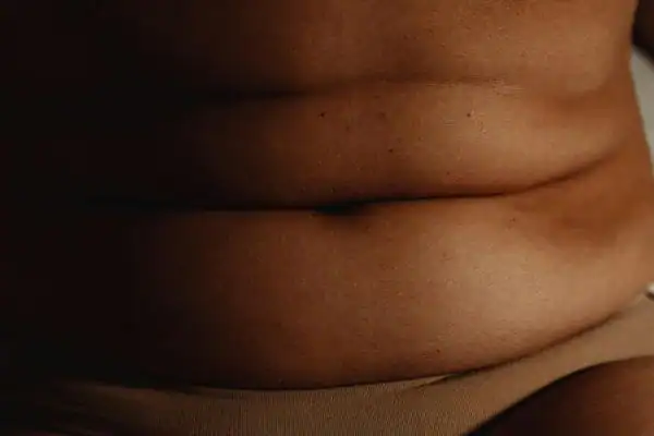 The Hidden Connection: How Stress Shapes Your Fitness and Body Composition 3 image of what stress can do on the stomach area and how Lipo 360 Bournemouth can help to change your body shape.